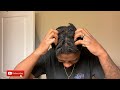 How to STOP Your Starter Locs From Itching (On a Budget) | Thick Loc Journey  #starterlocs