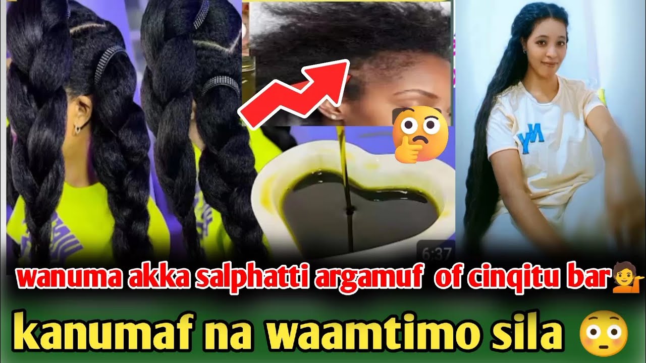 🎈 wanuma akka salphatti argamuf of cinqitu bar💁kanumaaf na waamtimo sila😳#kebekiofficial 👂👈👌