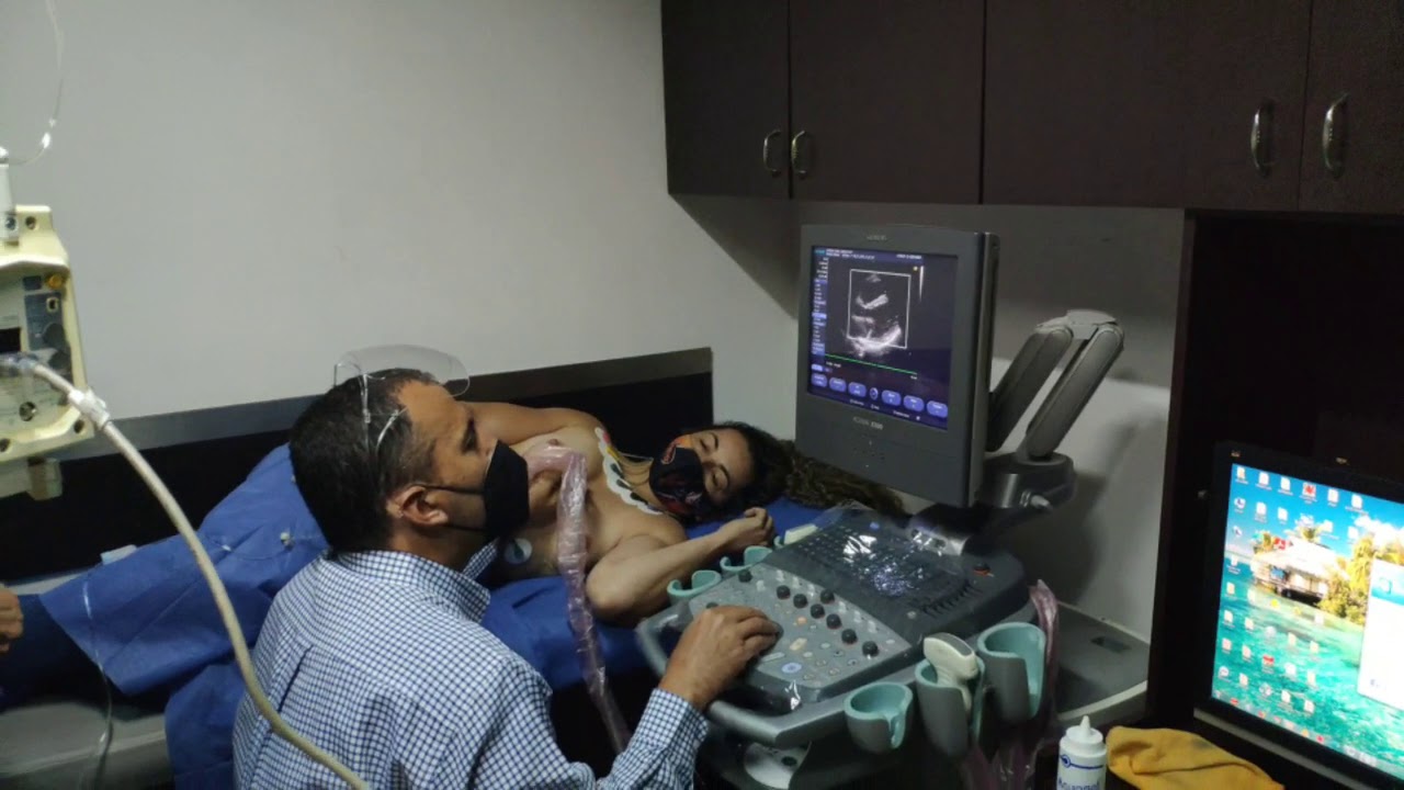 Ecocardiograma Stress con Dobutamina