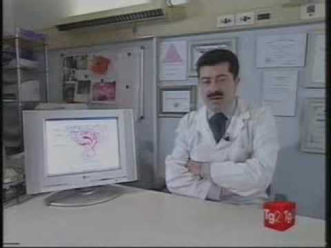 Endometriosi - Prof. Pietro Giulio Signorile - Cam...