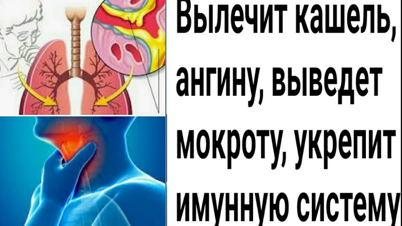 Может ли при ангине быть кашель. Может ли при ангине быть кашель
