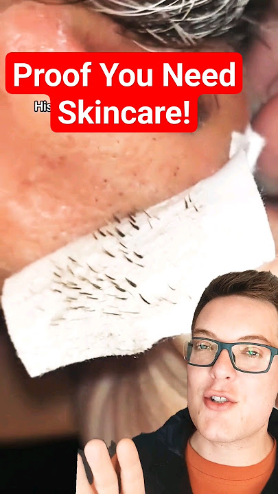 PROOF YOU NEED SKINCARE - Shocking Pore Strip Removal #shorts