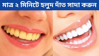 হলুদ দাঁত সাদা করার সহজ উপায় | Dat sada korar upay | teeth whitening at home | get white teeth screenshot 3
