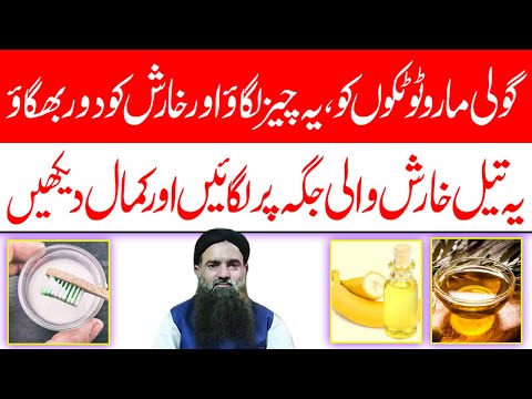 Kharish Ka Elaj Itching Treatment At Home Dr Sharafat Ali
