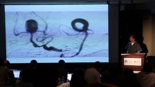 Balloon and Stent Assistance
