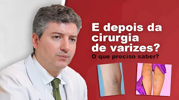 Como dormir depois de uma cirurgia as varizes?