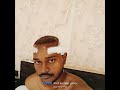 My Hair transplant srgery day 1 #transplant #transplantation #hair #transplant_surgery #surgery