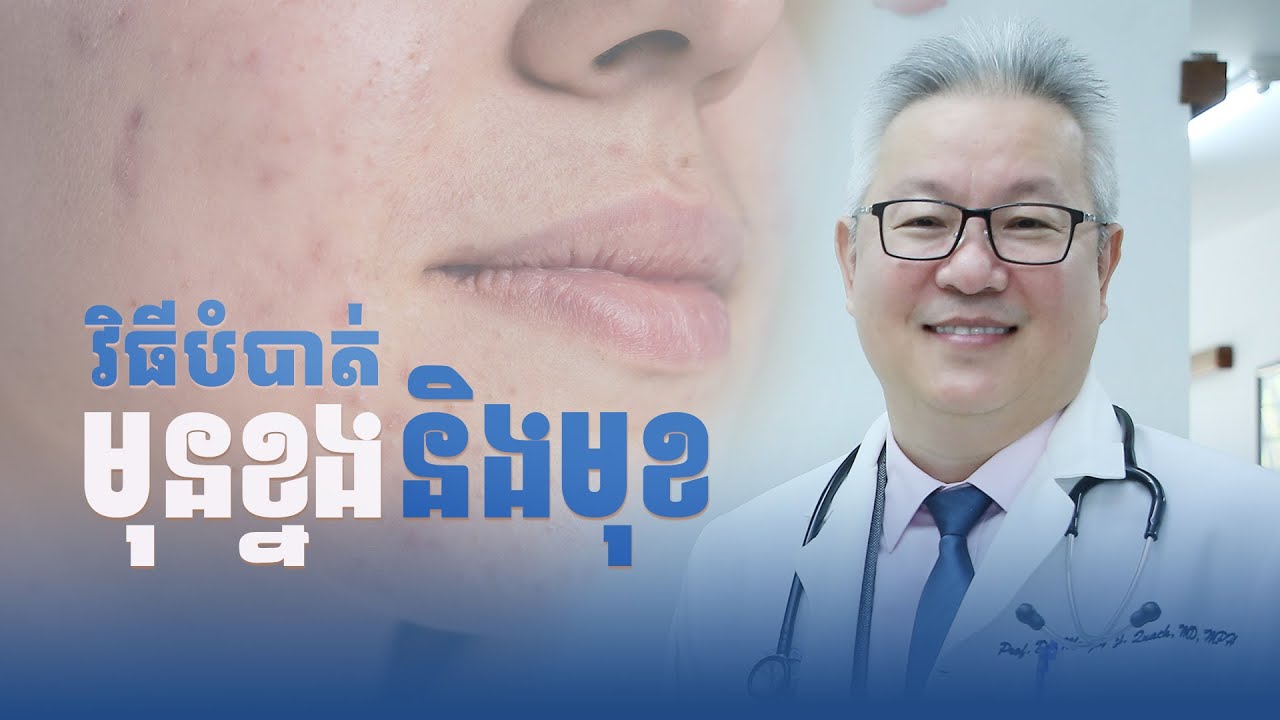 វិធីបំបាត់មុនខ្នង និងមុខ