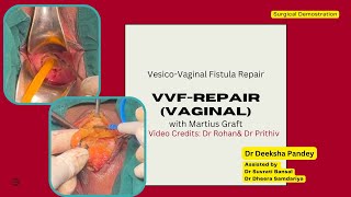 Vesico-Vaginal Fistula | Repair by vaginal approach |  Martius Graft | Dr Deeksha Pandey