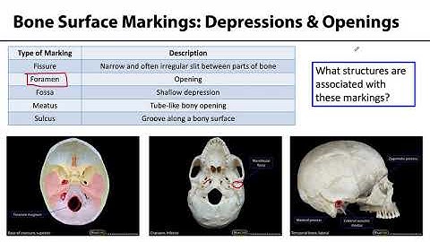 MSK Skeletal System Basics - Bone Surface Markings