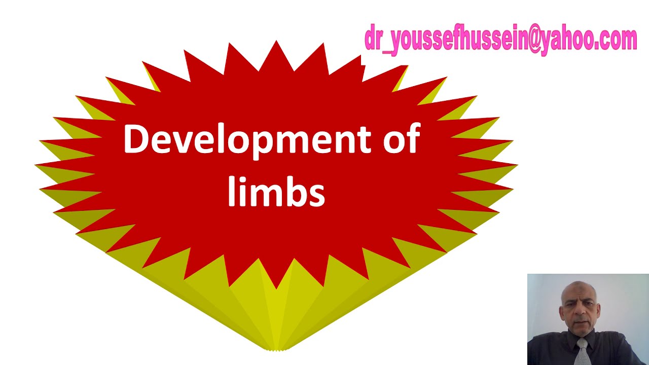 Development  limbs | Congenital anomalies | Limb | Hand | Foot | Talipes | Lobster | Syndactyl