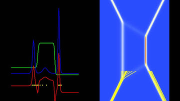 The Resonant Nonlinear Schrödinger Equation in the Causal Interpretation of Quantum Theory