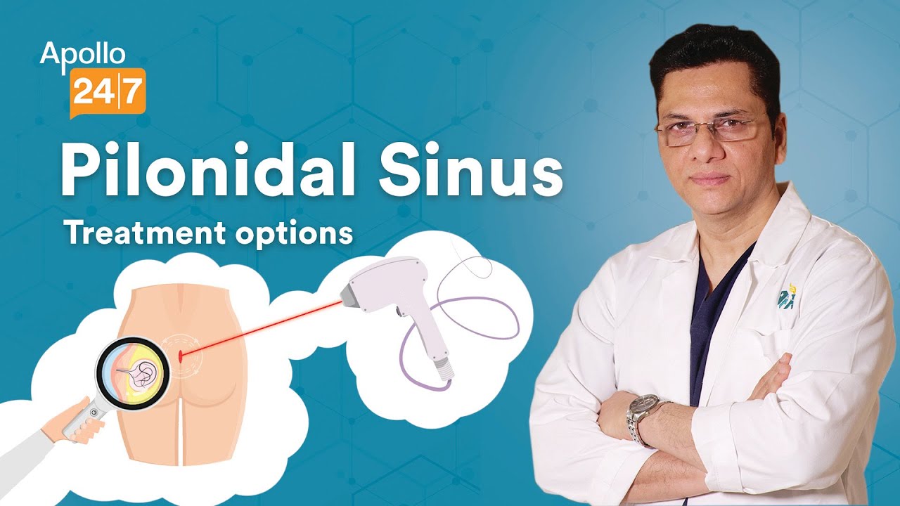 Treatment Options for Pilonidal Sinus