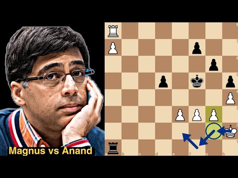 Legends Anand and Carlsen face off in Global Chess League