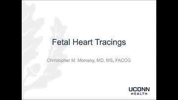 Fetal Heart Tracings
