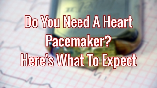 What to Expect From Pacemaker Surgery