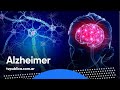 ¿Cómo diagnosticar el Alzheimer? - En Casa Salud