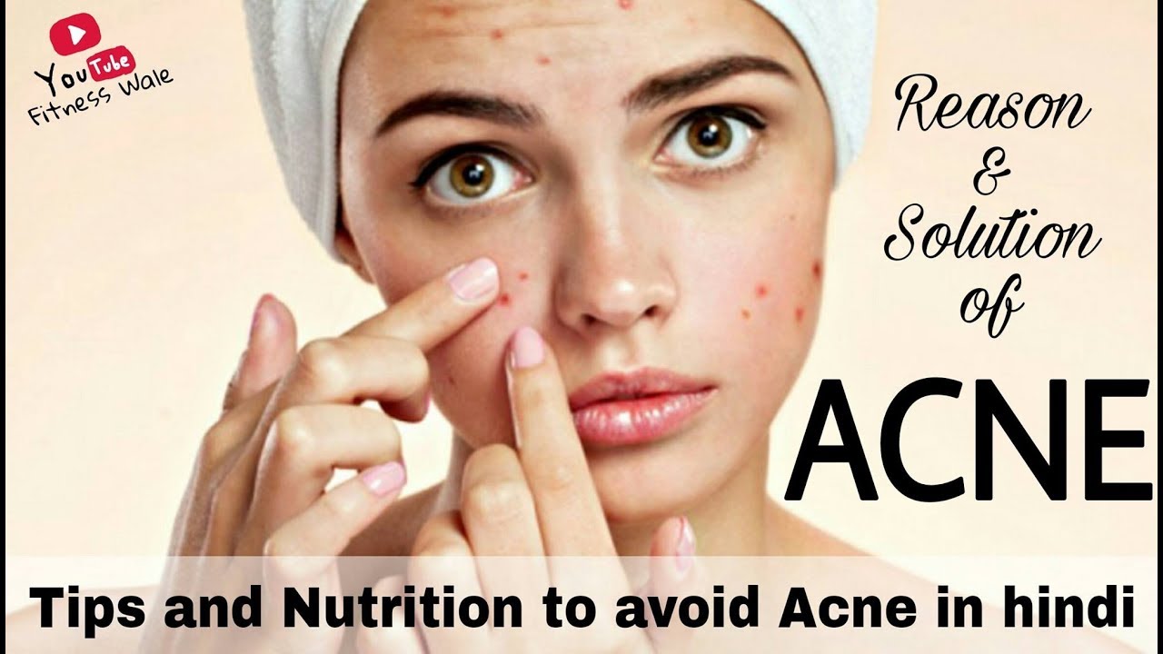 Tips For Removing Acne and Pimples Hindi YouTube