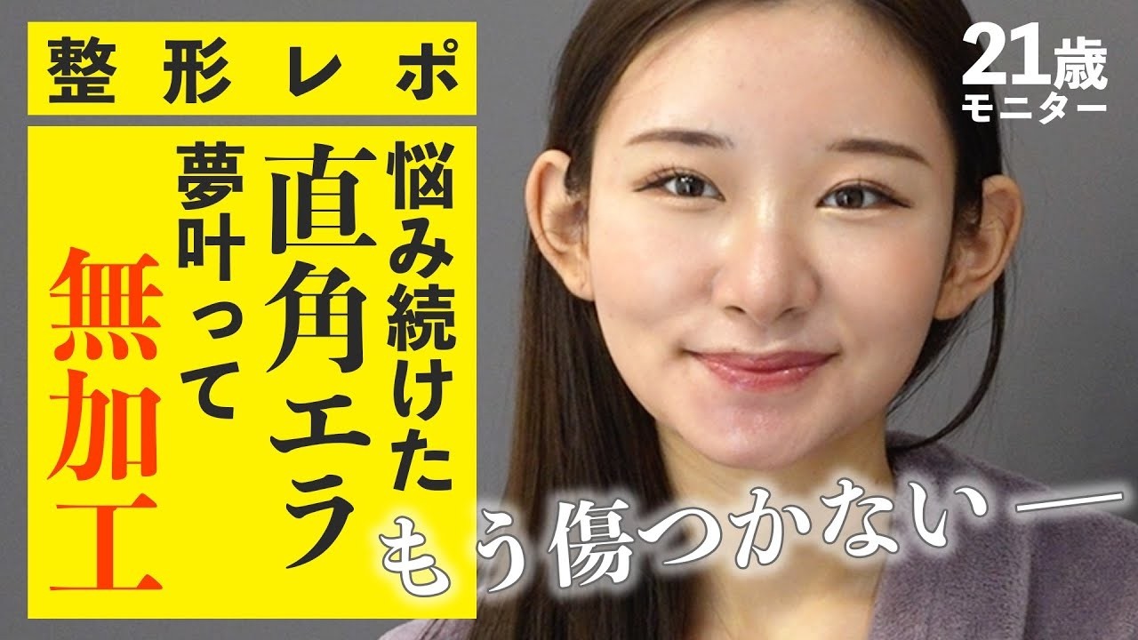 Plastic Surgery Report] My long-standing complex, 