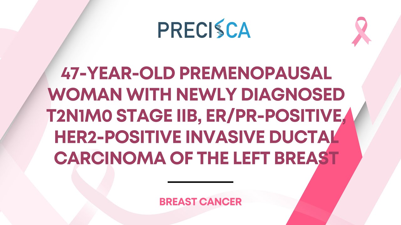 Expert Cancer Panel: Premenopausal female w/ newly diagnosed stage IIB ...