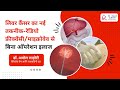 Best treatment options for liver cancer  dr amol lahoti