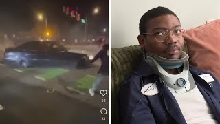 Man seriously injured in Richmond street takeover speaks out