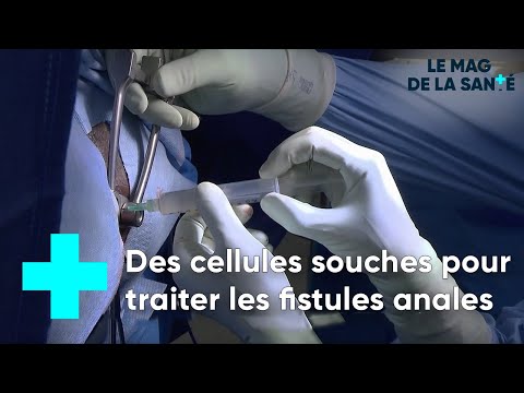 Vidéo: Comment guérir une fistule (avec photos)