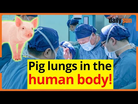 Chinese scientists transplanted a pig's lung into the body of a brain-dead person. | Daily Sun