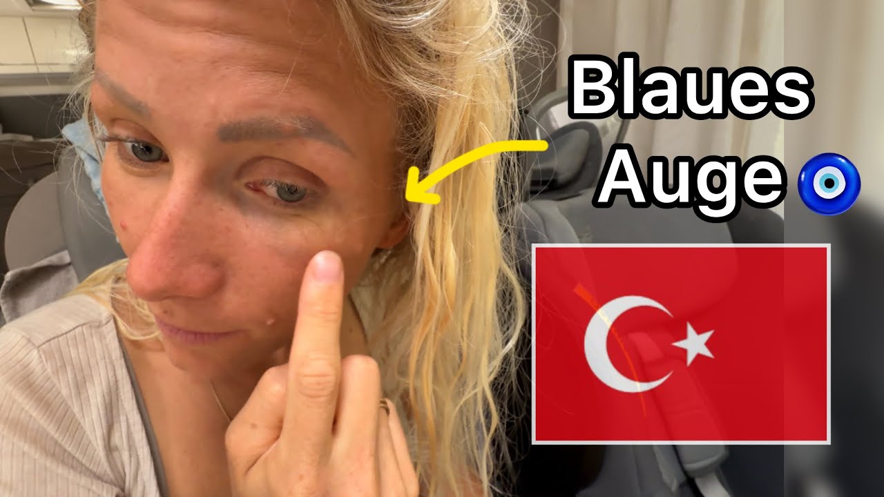 Blaues Auge für Mops 😳 Kalkan - Türkei 🇹🇷 #25