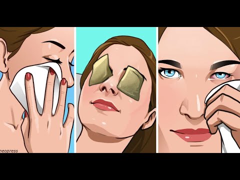 8 эффективных домашних средств от конъюнктивита