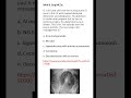 Medicine & Surgery MCQs (For MBBS, USMLE, MCCQE & PLAB)