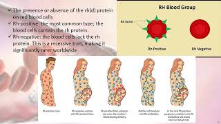 Blood group system, Lutheran system, MNS, Kell, duffy, bombay blood group, ABO, rh blood group #abo