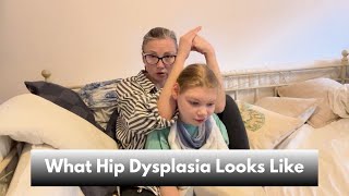 Hip Dysplasia in Disabled Children: Signs, Pain &amp; Treatment Explained