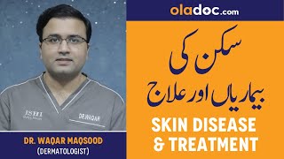 Common Skin Disease & Treatment Urdu Hindi- Jild Ki Bemarian Aur Ilaj - ACNE, MOLES, WARTS, ALOPECIA screenshot 4