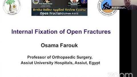 Internal Fixation of Open Fractures ( Prof. Osama Farouk )
