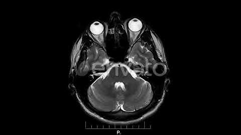 Human Brain MRI Scan - Alpha Channel | Motion Graphics - Envato elements