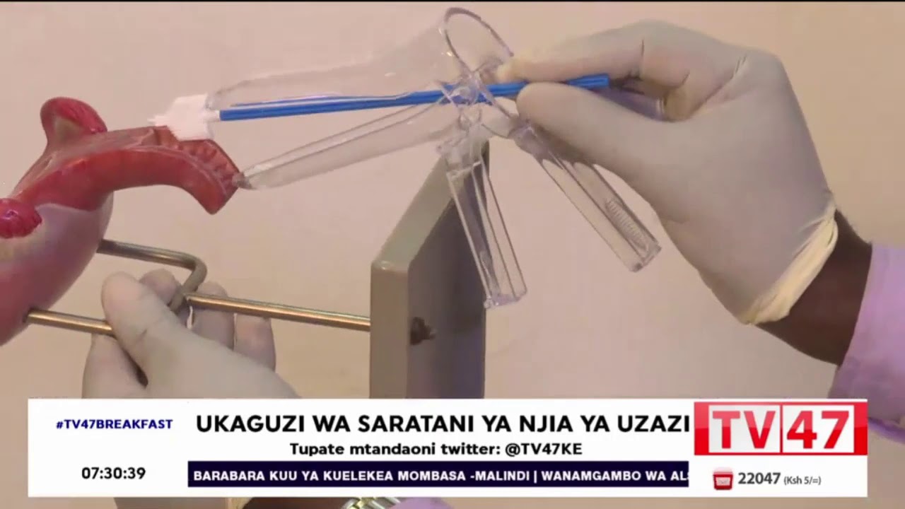 Watch The Process Of Getting A Pap Smear Examination To Detect Cervical Watch The Process Of Getting A Pap Smear Examination To Detect Cervical