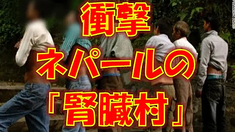 驚愕 ネパールの腎臓村 村人の成人ほとんどが腎臓が１つしかない تحميل Download Mp4 Mp3