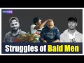 Struggles of bald men  heyy baandli  akarsha kamala  metrosaga