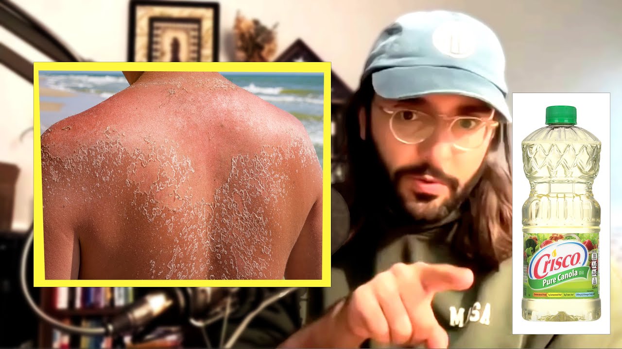 The Sun Does Not Cause Skin Cancer Steven Arena YouTube
