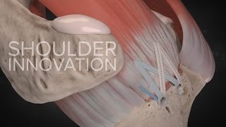 What's New in Orthopaedic Innovations