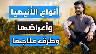 انواع الانيميا المختلفه واعراضها وافضل الطرق لعلاجها