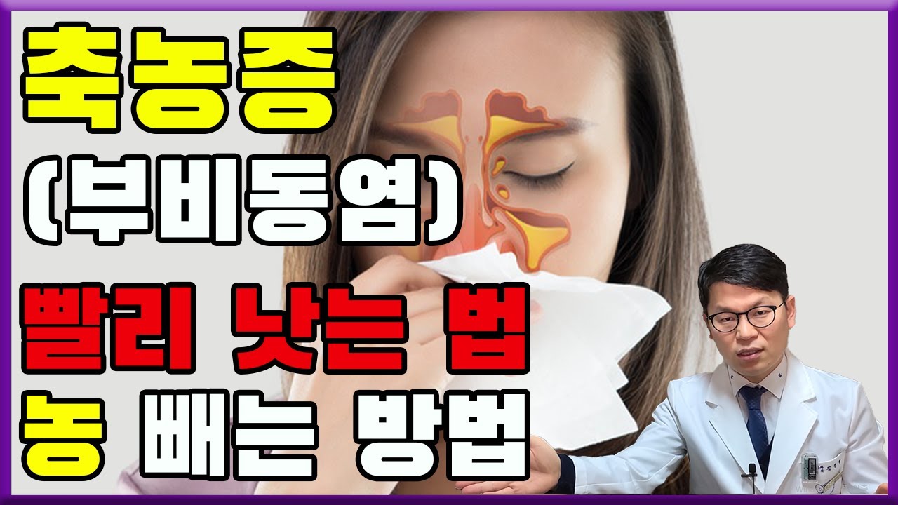 축농증(부비동염) 진단과 치료 | 이비인후과 의사가 추천하는 축농증(부비동염) 빨리 낫는 방법 | 오공작가