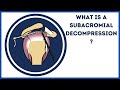 What is a subacromial decompression? Mp3 Song
