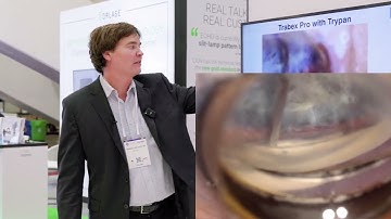 Dr. Noecker explains Why Goniotomy with TrabEx PRO