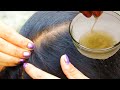 NATURAL REMEDIES FOR HAIR REGROWTH | MAKE YOUR OWN HOMEMADE HAIR GROWTH OIL FOR HAIR LOSS