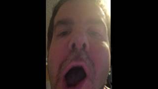 IMG 3281
