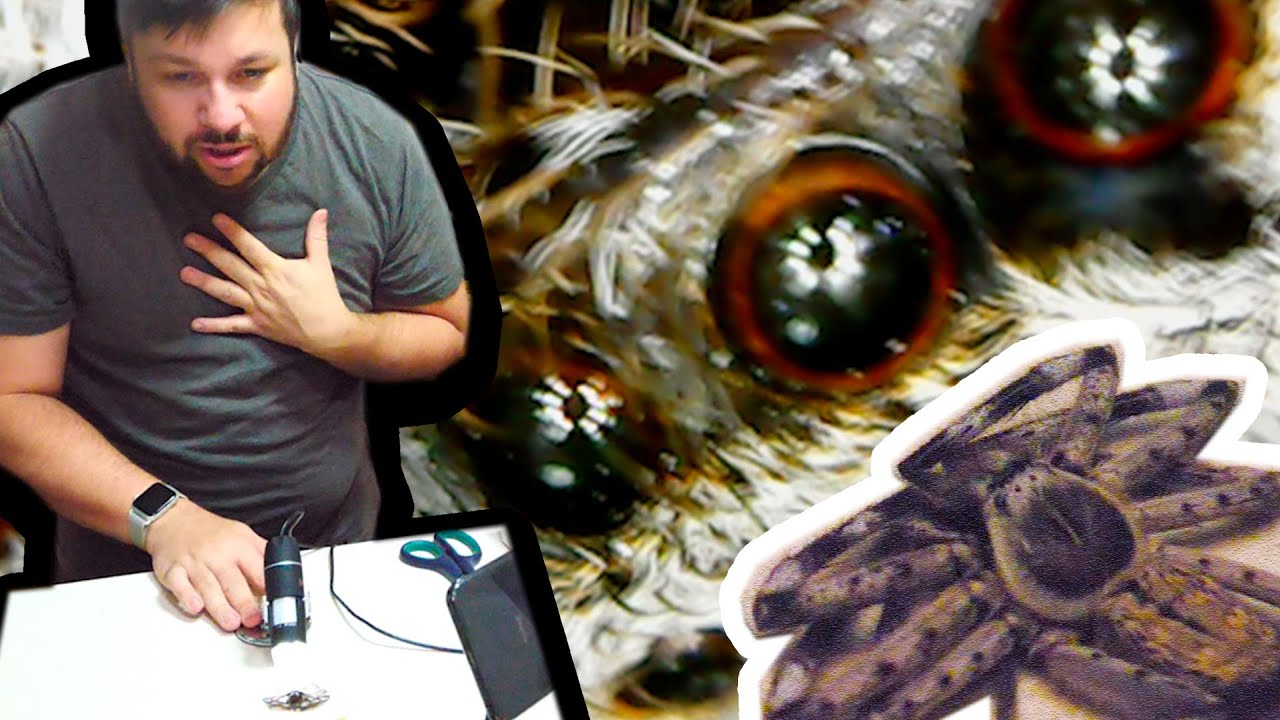 MY BIGGEST FEAR | Looking At A Spider Under The Microscope