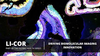 LI-COR Biotechnology - Advancing the Future of Biomolecular Imaging