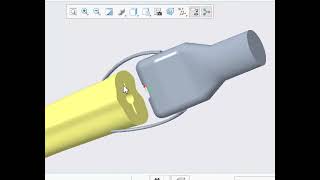 CAD Design & Finite Element Analysis of Knee Joint TKR Implant: femur tibia bone, cartilage meniscui
